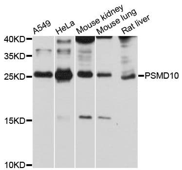 PSMD10 / Gankyrin Antibody