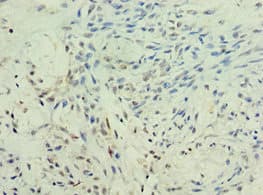 KMO Antibody (aa1-260)