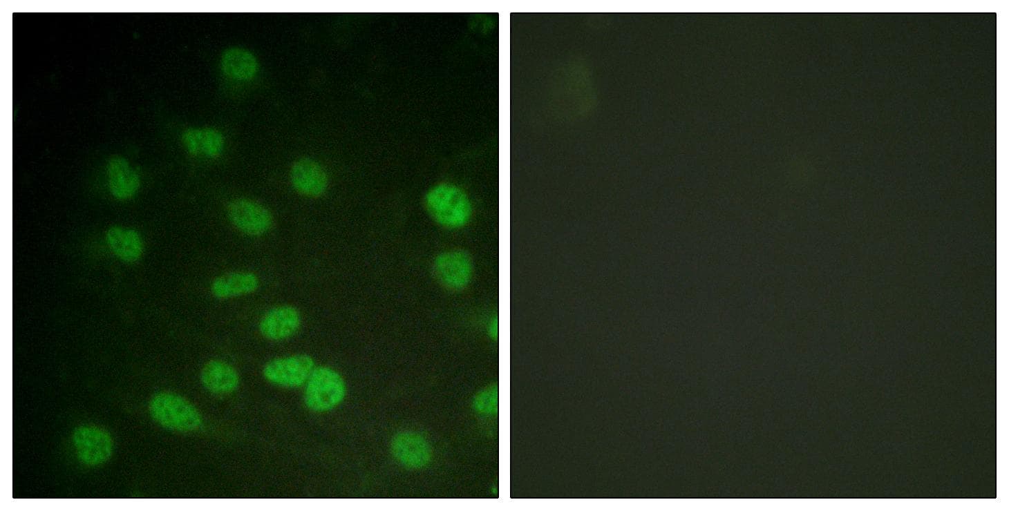 DDX3 / DDX3X Antibody (phospho-Thr322)