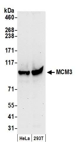 Polyclonal Rabbit anti-Human MCM3 Antibody (aa500-550, IHC, WB)
