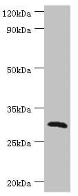 Polyclonal Rabbit anti-Human CLEC12A / CD371 Antibody (aa66-265, IHC, WB)