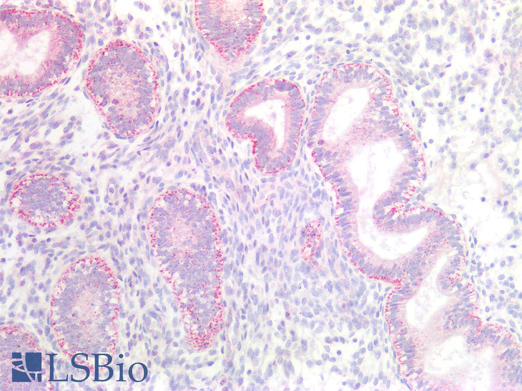 IHC-plus™ Polyclonal Rabbit anti-Human HTR1A / 5-HT1A Receptor Antibody (IHC, WB)