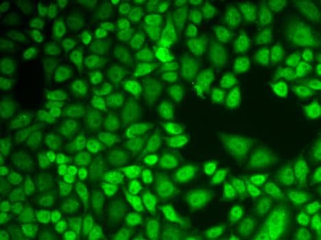 CTSD / Cathepsin D Antibody