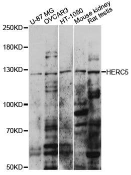 CEB1 / HERC5 Antibody