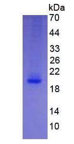 Human IL4 Protein (Recombinant His, N-Terminal)