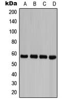 CASP8 / Caspase 8 Antibody (phospho-Tyr380)