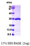 Human RAP1B Protein (Recombinant His)
