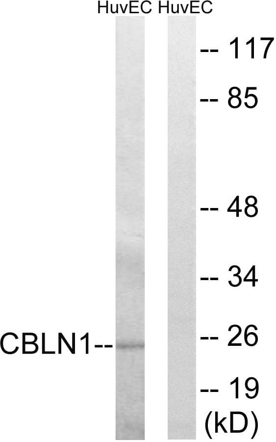 Polyclonal Rabbit anti-Human CBLN1 / Cerebellin 1 Antibody (WB)