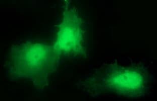 Monoclonal Mouse anti-Human CHAC1 / MGC4504 Antibody (clone OTI1E2, Carrier-free, IHC, IF, WB)