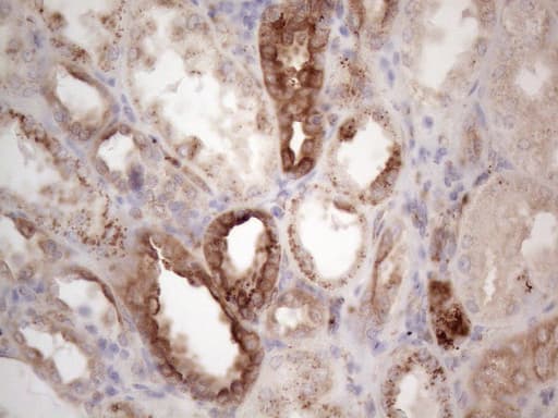 LPIN1 / Lipin 1 Antibody (clone OTI7F5)