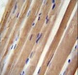 INPP5B Antibody (aa950-979)