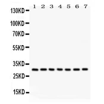 NQO1 Antibody (aa242-274)