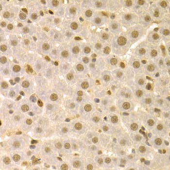 SFN / Stratifin / 14-3-3 Sigma Antibody