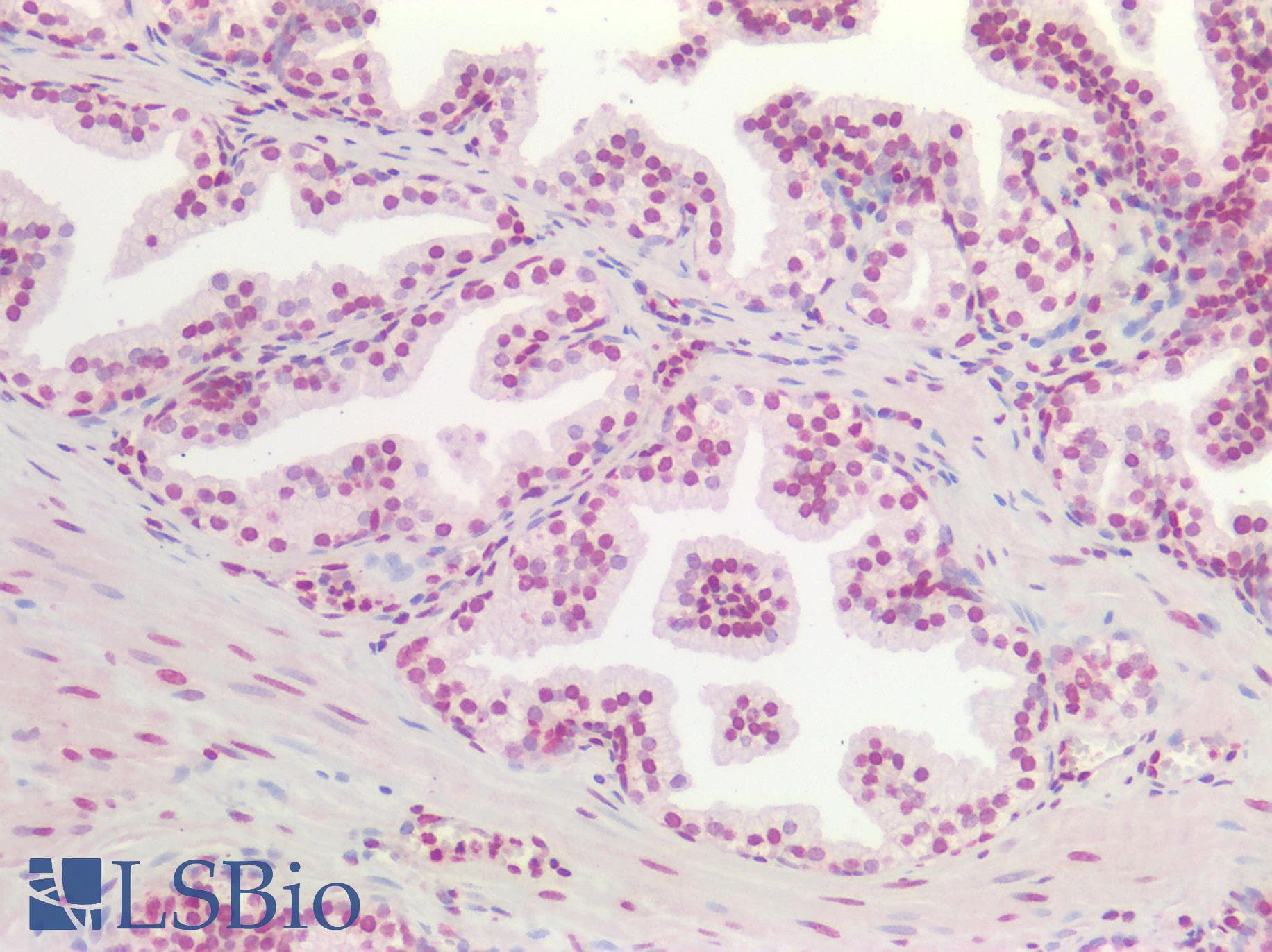 PathPlus™ AKT1 Antibody