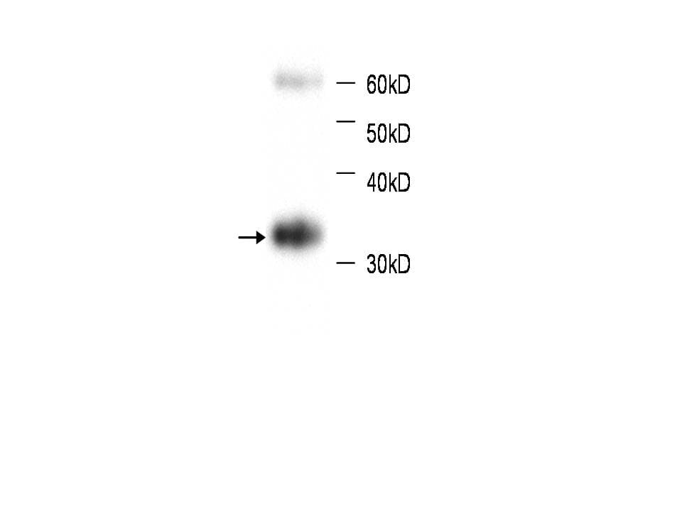 Monoclonal Mouse anti-Human HBB / Hemoglobin Beta Antibody (WB)