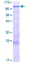 Human SNARK / NUAK2 Protein (Recombinant GST)