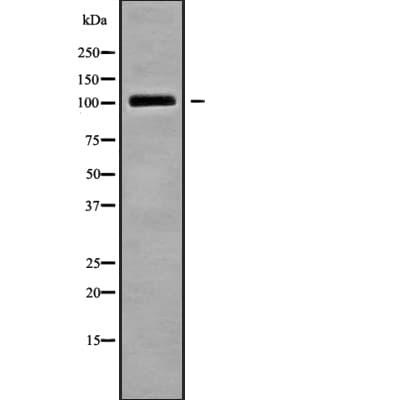 TRAK2 Antibody