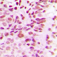 DNMT3B Antibody (N-Terminus)