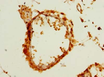 LDAH Antibody