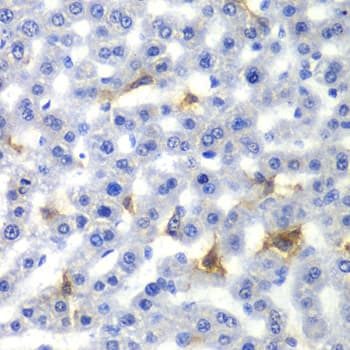 Polyclonal Rabbit anti-Human NR0B2 Antibody (IHC, IF, WB)