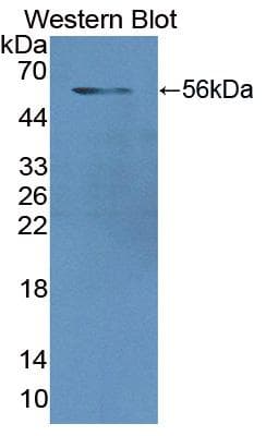 GSR / Glutathione Reductase Antibody (aa44-522)