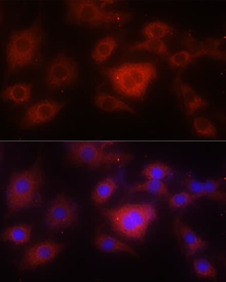 SOD2 / Mn SOD Antibody
