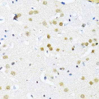 Polyclonal Rabbit anti-Human ITGB3BP Antibody (IHC)