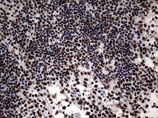 SH3BGRL Antibody (clone OTI8F7)