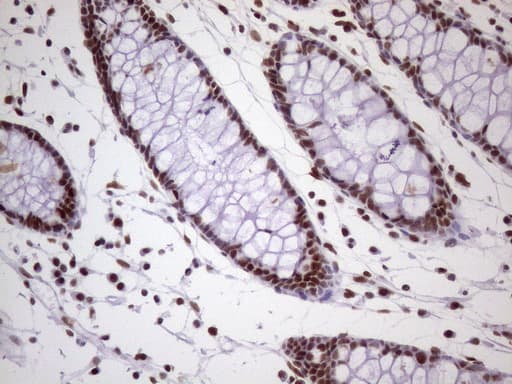 NUDT21 Antibody (aa2-227, clone OTI1B1)