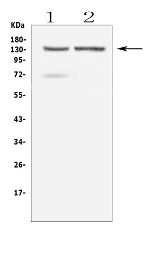 Polyclonal Rabbit anti-Human RTEL1 Antibody (WB)