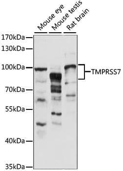 Polyclonal Rabbit anti-Human TMPRSS7 Antibody (WB)