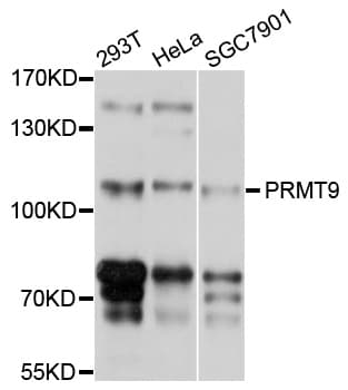 PRMT9 / PRMT10 Antibody