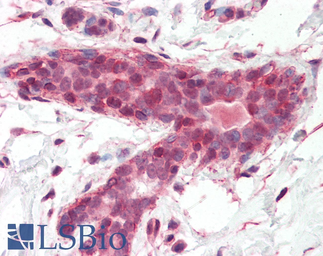 IHC-plus™ Polyclonal Rabbit anti-Human BRAP2 Antibody (aa67-79, IHC)