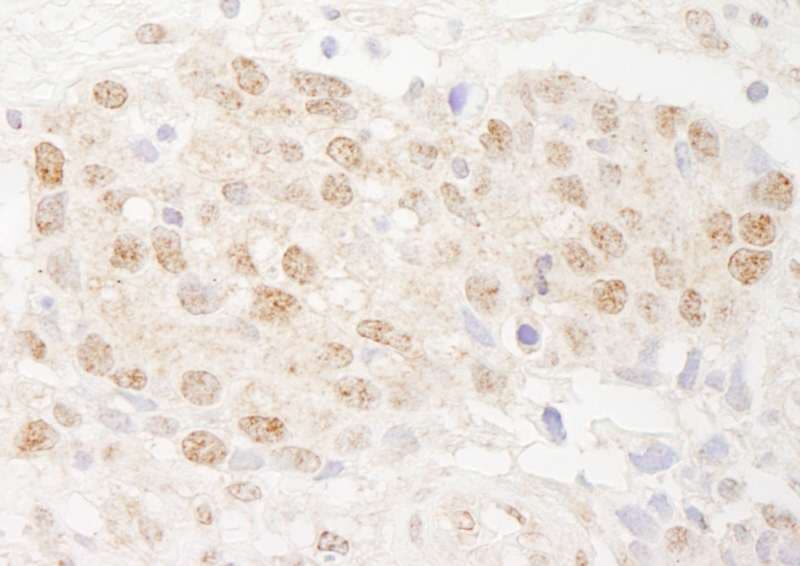 Polyclonal Rabbit anti-Human DMWD Antibody (aa609-659, IHC, WB)