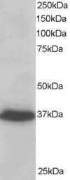 IHC-plus™ PDLIM4 / RIL Antibody (aa317-330)