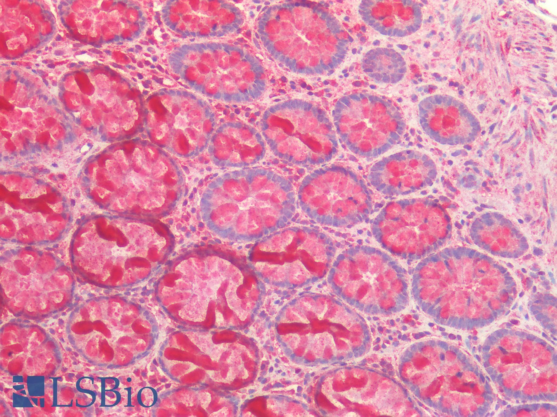 PathPlus™ PRDX3 / Peroxiredoxin 3 Antibody (aa206-256)