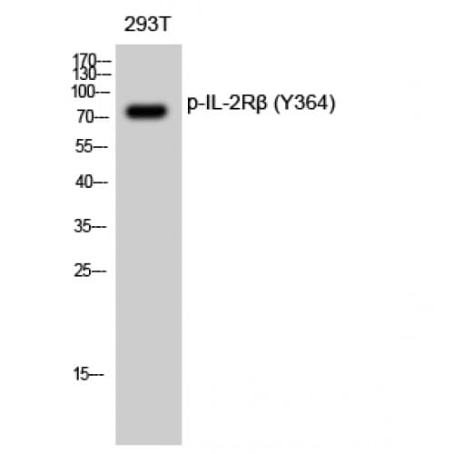 IL2RB / CD122 Antibody (300-380 aa)