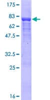 Human WDR18 Protein (Recombinant GST)