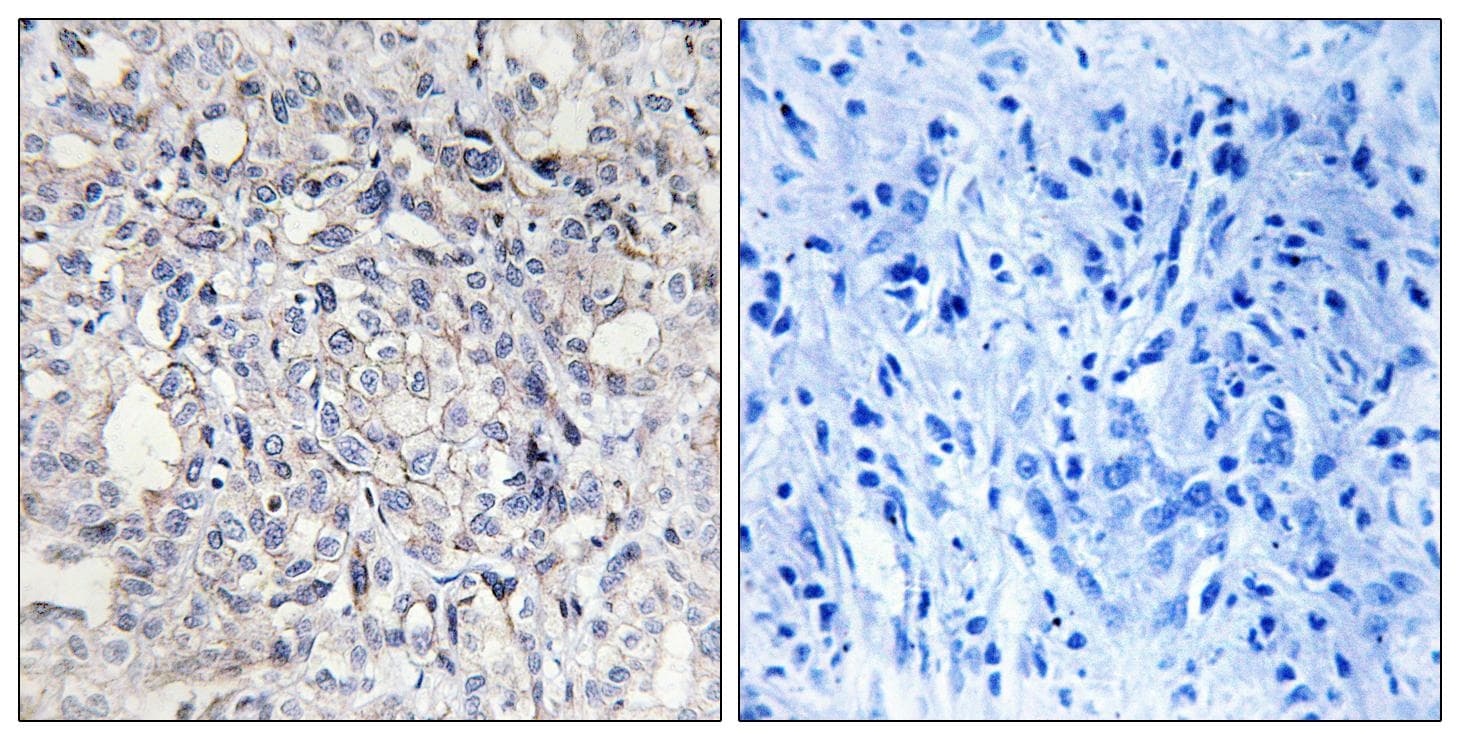 SERPIND1 / Heparin Cofactor 2 Antibody