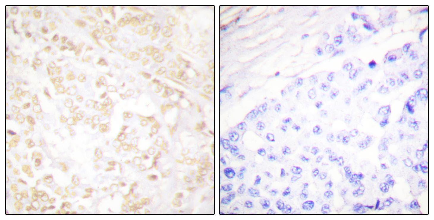 XRCC6 / Ku70 Antibody