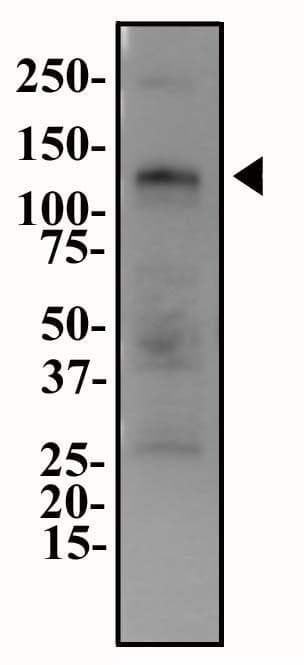 ENPP1 Antibody (Biotin)