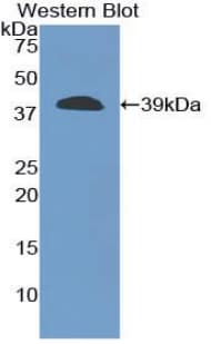 CPB / Carboxypeptidase B Antibody (aa109-415)