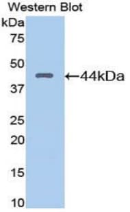 Angiostatin Antibody (aa98-436)