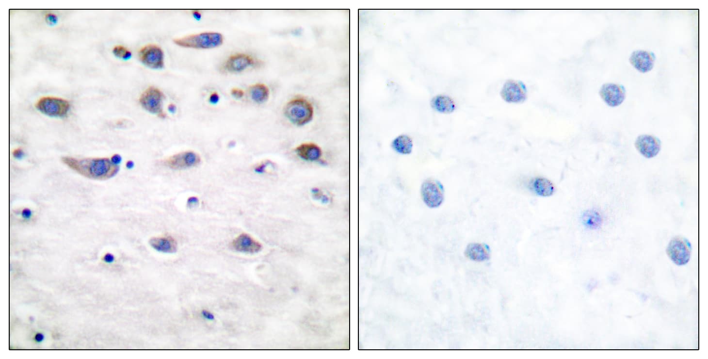 Polyclonal Rabbit anti-Human GRIA1 / GLUR1 Antibody (phospho-Ser849, IHC)