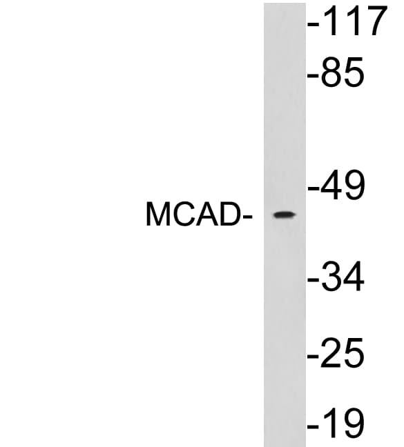 IHC-plus™ MCAD / ACADM Antibody (aa134-183)