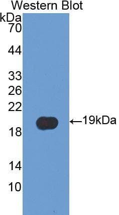 PPIA / Cyclophilin A Antibody (aa2-165)