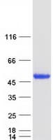 Human PPM1A / PP2CA Protein (Recombinant Myc-DDK (Flag))