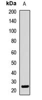 Polyclonal Rabbit anti-Human ZFAND3 / TEX27 Antibody (IHC, WB)