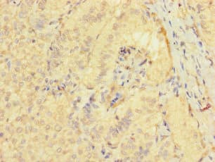 TSPAN32 / PHEMX Antibody