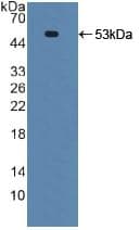TNFRSF10B / Killer / DR5 Antibody (aa234-435, APC)